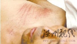 女子駕車碾壓農(nóng)民工后多次返回現(xiàn)場沖撞人群(圖)