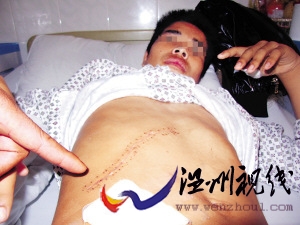 \"兩名少年抓賊被刺一人身中8刀竊賊自稱遭追殺\"