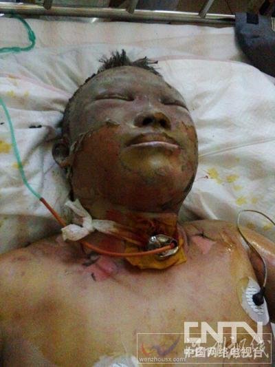 張洪濤已被送往哈爾濱市第五醫院救治。