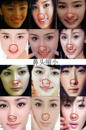 疑似整容部位:內眼角