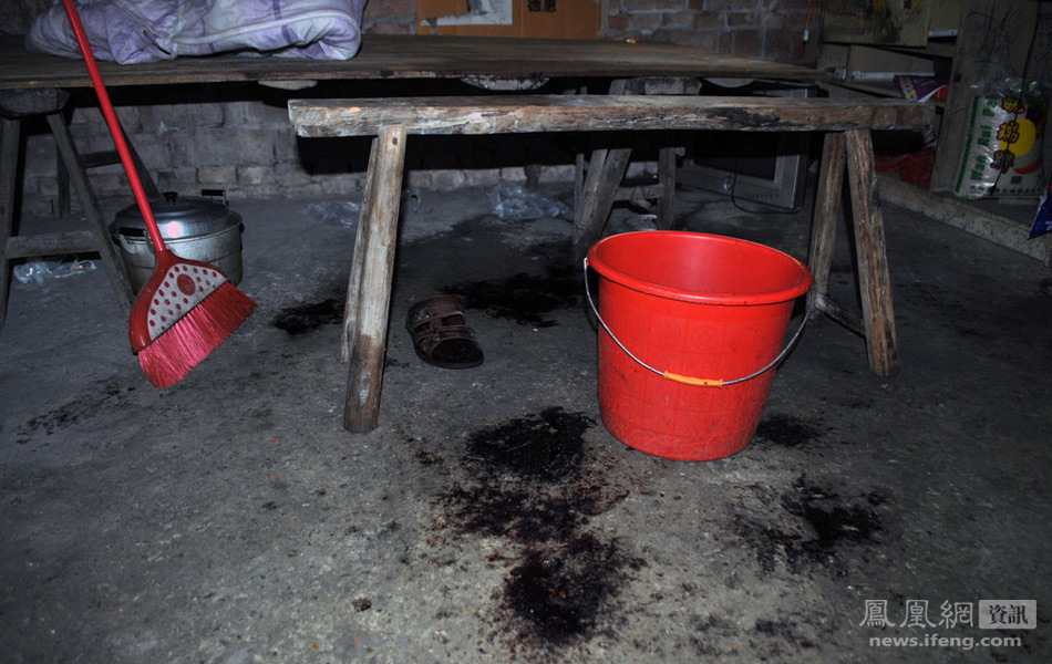 男子睡夢中被人割掉下體