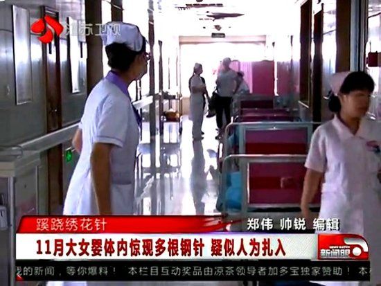 女嬰體內4根繡花針