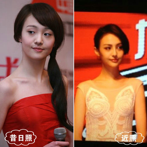 鄭爽整容后照片