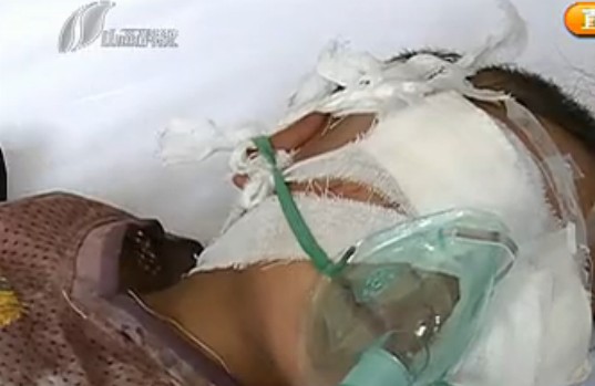 男孩被挖雙眼報道截圖