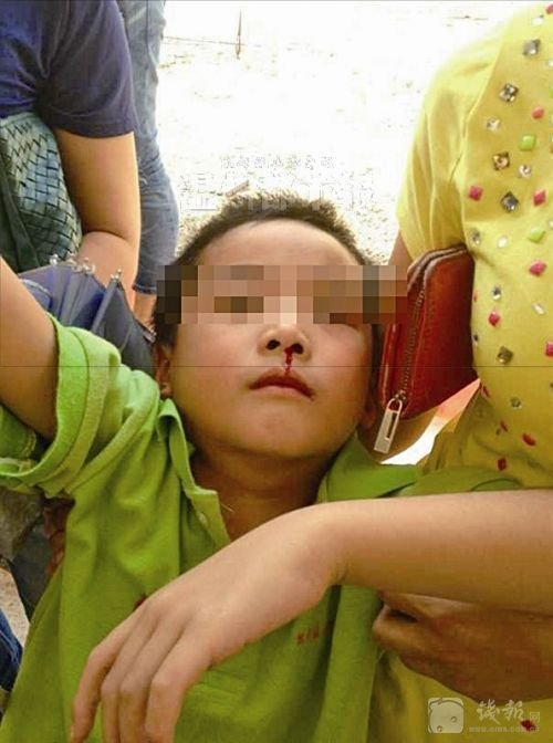 溫州樂清市北白象鎮(zhèn)第九小學(xué)19名學(xué)生氣體中毒