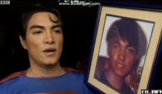 菲律賓男子整容13次成超人