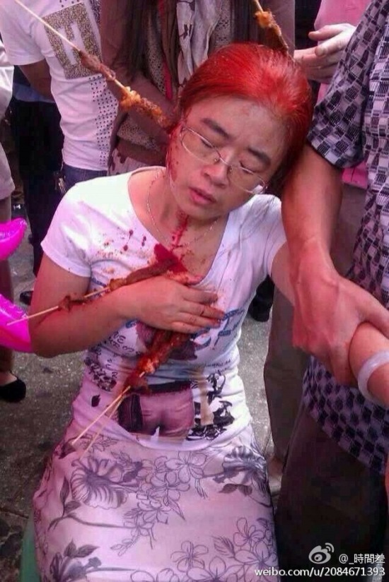 貴陽市民買羊肉串被刺傷
