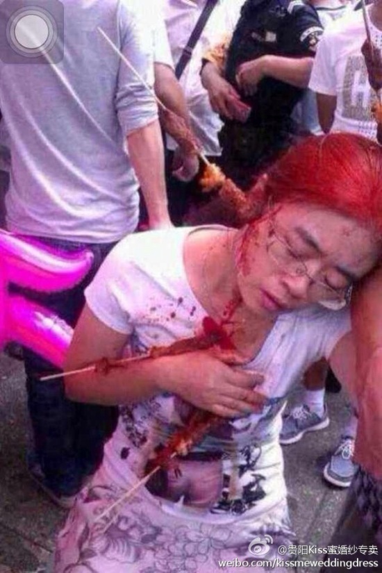 貴陽市民買羊肉串被刺傷