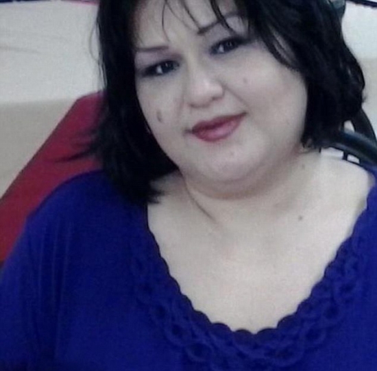 美國最胖女子梅拉體重544公斤