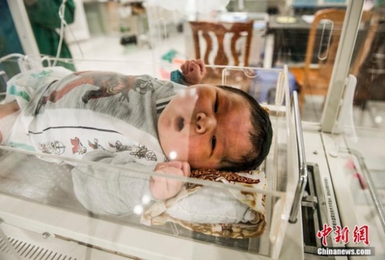 女子產下14斤巨嬰