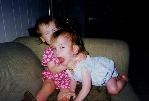 連體嬰姐妹分離變美女