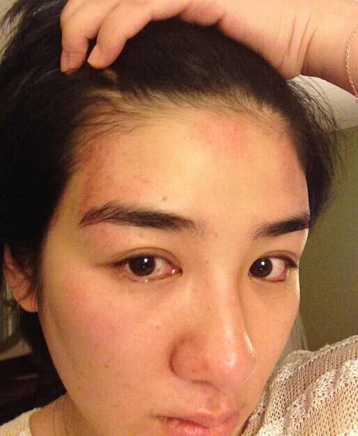 黃奕曬遭家暴照片 指責丈夫在自己懷孕期間出軌