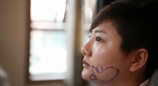 王梓整容前后對比 微博直播整容過程