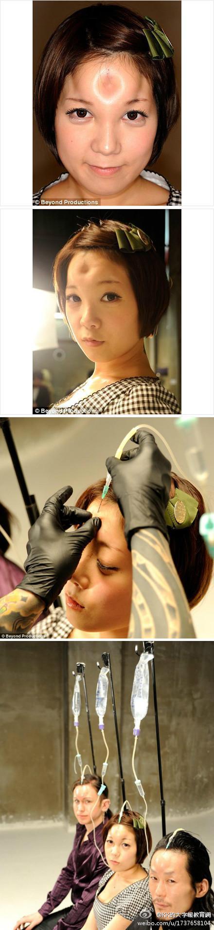 黃奕家暴是假的 額頭凹進去是用手指按的