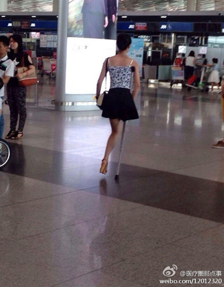 獨腿女孩正面照