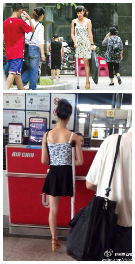 獨腿女孩穿高跟鞋照片