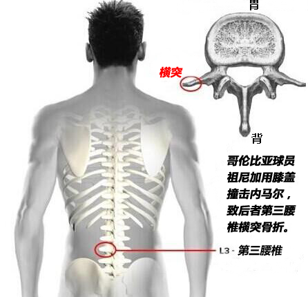 內馬爾重傷告別世界杯