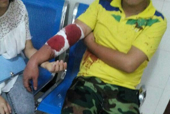 軍訓教官與師生沖突多名學生受傷