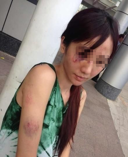 廣西美女演員被家暴