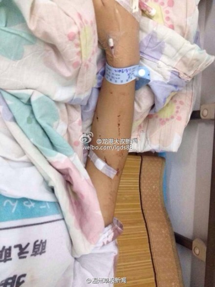 蒼南一中學(xué)女生拿剪刀捅傷同學(xué)