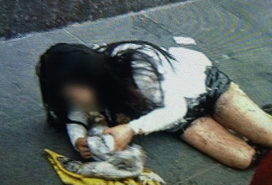 西安一女子當街被潑硫酸