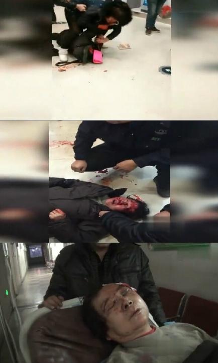 我眼鏡三萬(wàn)多