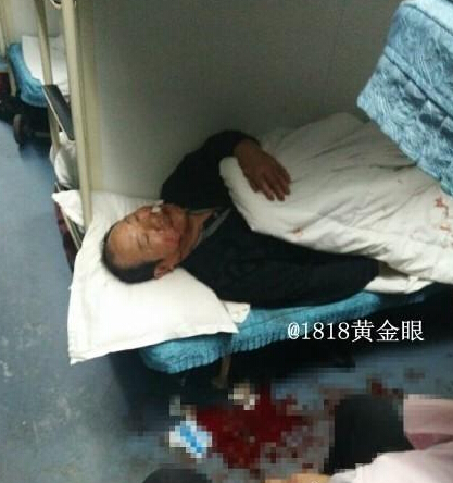 列車上男子用滅火器砸傷多人