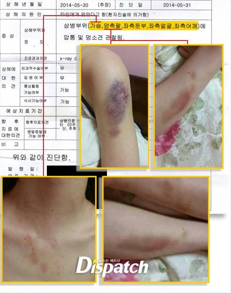 韓國女星素珍跳樓自殺