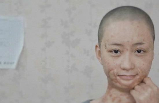 遭官二代毀容少女周巖