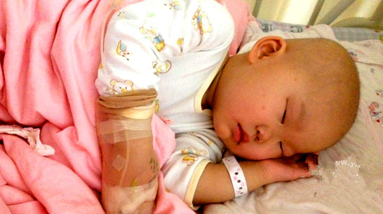 永嘉21個月大女嬰患白血病