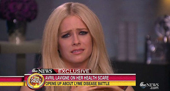 艾薇兒確診患萊姆病后接受采訪