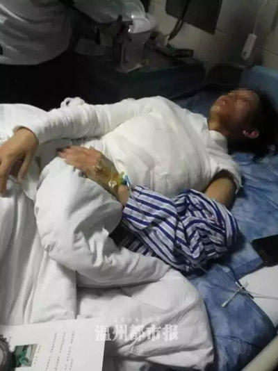 女子遭服務員潑熱湯