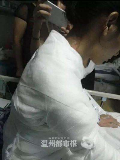 女子遭服務員潑熱湯