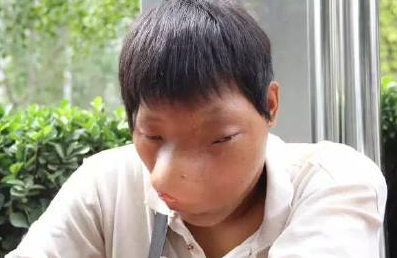 河南大學生患怪病