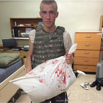 數十人在枕頭大戰中受傷