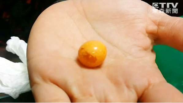 椰子螺吐出美樂珠