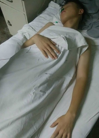 河北教官打傷高中生:手持鋼管 20人被打至鼻青臉腫