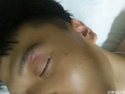 教官打傷高中生