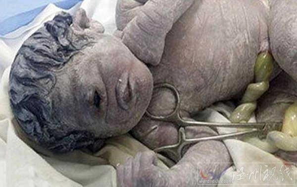 埃及獨(dú)眼嬰兒