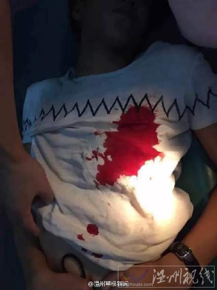 溫州一快遞員送件送晚被捅傷