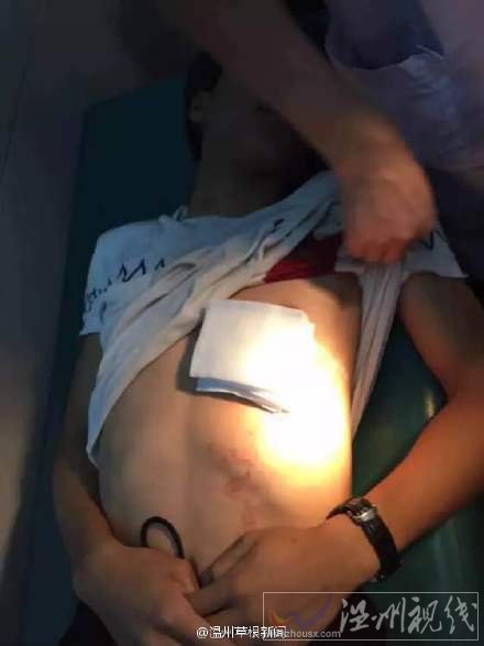 快遞員被用剪刀插了一下