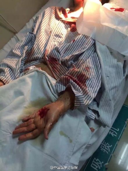 廣醫三院女護士被病人刺傷