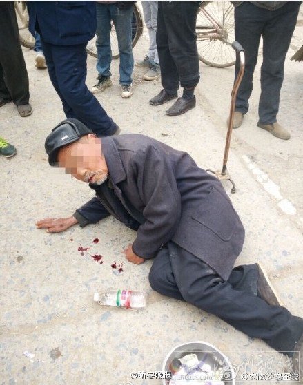 宿州八旬老人吐血乞討