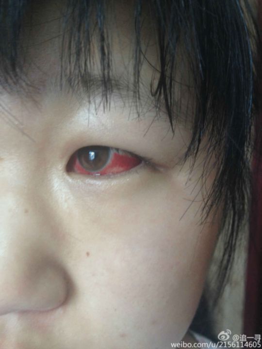 吉林學生集體中毒