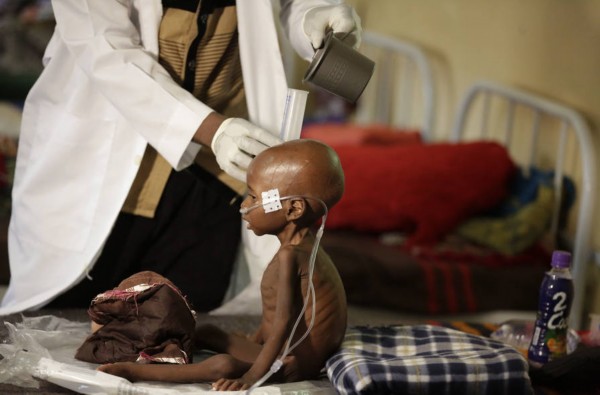 尼日利亞難民饑荒