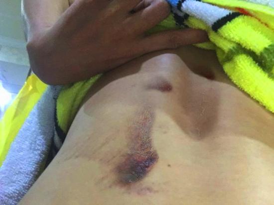 傳G姓女演員墜崖 郭柯彤回應和墜崖無關