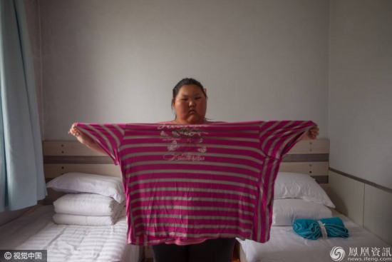 16歲女孩重330斤