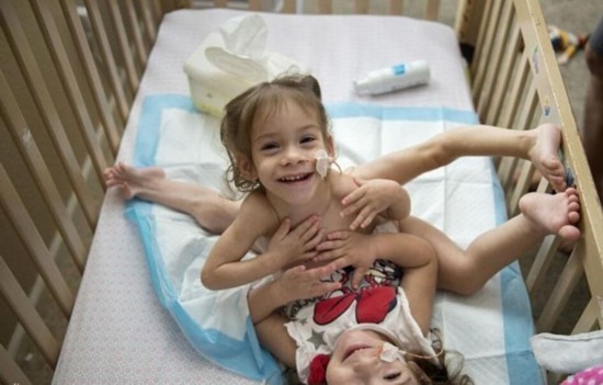 姐妹共用三條腿