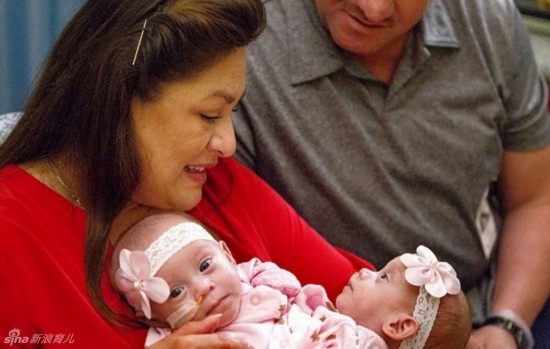 姐妹共用三條腿