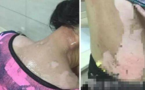 開水潑女顧客案續(xù)